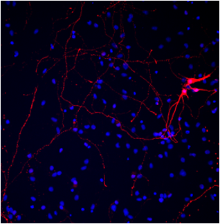Neurones malades + CXS003